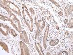 PCID2 Antibody in Immunohistochemistry (Paraffin) (IHC (P))