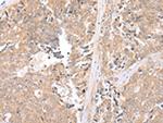 MMGT1 Antibody in Immunohistochemistry (Paraffin) (IHC (P))