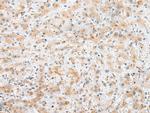 C22orf41 Antibody in Immunohistochemistry (Paraffin) (IHC (P))