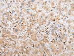 NPL Antibody in Immunohistochemistry (Paraffin) (IHC (P))