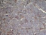 UGT3A1 Antibody in Immunohistochemistry (Paraffin) (IHC (P))