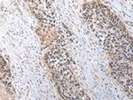 C1QB Antibody in Immunohistochemistry (Paraffin) (IHC (P))