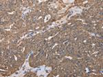 RARS Antibody in Immunohistochemistry (Paraffin) (IHC (P))