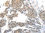 MAGEA6 Antibody in Immunohistochemistry (Paraffin) (IHC (P))