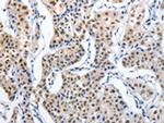 MAGEA6 Antibody in Immunohistochemistry (Paraffin) (IHC (P))