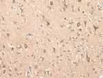 ADAM19 Antibody in Immunohistochemistry (Paraffin) (IHC (P))