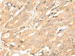 ADAM19 Antibody in Immunohistochemistry (Paraffin) (IHC (P))