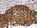 TACC2 Antibody in Immunohistochemistry (Paraffin) (IHC (P))