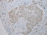 TUSC5 Antibody in Immunohistochemistry (Paraffin) (IHC (P))