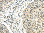 WRCH1 Antibody in Immunohistochemistry (Paraffin) (IHC (P))