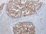 ADAMTS3 Antibody in Immunohistochemistry (Paraffin) (IHC (P))