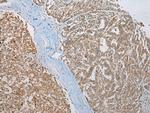 CCBL1 Antibody in Immunohistochemistry (Paraffin) (IHC (P))