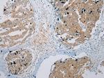 ZNF621 Antibody in Immunohistochemistry (Paraffin) (IHC (P))