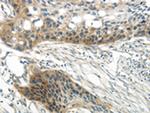 WNT6 Antibody in Immunohistochemistry (Paraffin) (IHC (P))