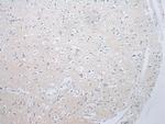 ADAMTS8 Antibody in Immunohistochemistry (Paraffin) (IHC (P))