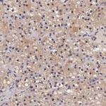 CHRDL1 Antibody in Immunohistochemistry (IHC)