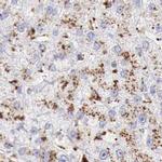 alpha Galactosidase Antibody in Immunohistochemistry (IHC)