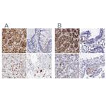 alpha Galactosidase Antibody in Immunohistochemistry (IHC)