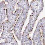 alpha Galactosidase Antibody in Immunohistochemistry (IHC)