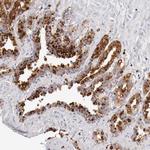 alpha Galactosidase Antibody in Immunohistochemistry (IHC)