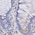 alpha Galactosidase Antibody in Immunohistochemistry (IHC)