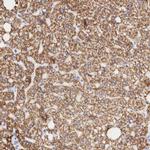 OTC Antibody in Immunohistochemistry (IHC)