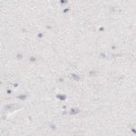 OTC Antibody in Immunohistochemistry (IHC)