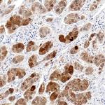 OTC Antibody in Immunohistochemistry (IHC)