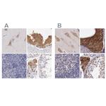 NSDHL Antibody in Immunohistochemistry (IHC)