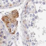 NSDHL Antibody in Immunohistochemistry (IHC)