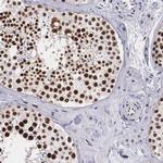 KHDRBS3 Antibody in Immunohistochemistry (IHC)