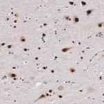 KHDRBS3 Antibody in Immunohistochemistry (IHC)