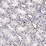 KHDRBS3 Antibody in Immunohistochemistry (IHC)