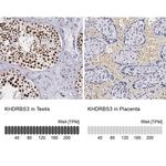 KHDRBS3 Antibody