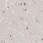 AUTS2 Antibody in Immunohistochemistry (IHC)