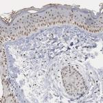 AUTS2 Antibody in Immunohistochemistry (IHC)