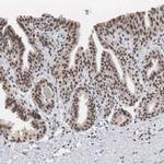 AUTS2 Antibody in Immunohistochemistry (IHC)