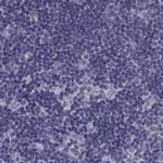 ZNF185 Antibody in Immunohistochemistry (IHC)