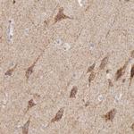 IDH3G Antibody in Immunohistochemistry (IHC)