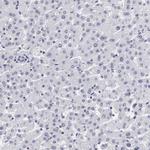 CSTF2 Antibody in Immunohistochemistry (IHC)