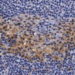 RENBP Antibody in Immunohistochemistry (IHC)