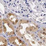 RENBP Antibody in Immunohistochemistry (IHC)