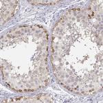 TKTL1 Antibody in Immunohistochemistry (IHC)