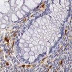 RENBP Antibody in Immunohistochemistry (IHC)