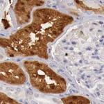 RENBP Antibody in Immunohistochemistry (IHC)