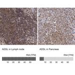 ADSL Antibody in Immunohistochemistry (IHC)