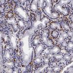 LGALS3BP Antibody in Immunohistochemistry (IHC)