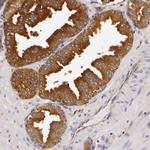 LGALS3BP Antibody in Immunohistochemistry (IHC)