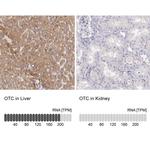 OTC Antibody in Immunohistochemistry (IHC)