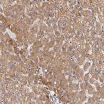 OTC Antibody in Immunohistochemistry (IHC)